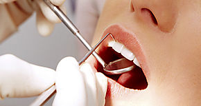 Mala salud bucal est vinculada a problemas de control de hipertensin muestra estudio