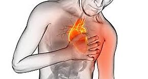Desarrollan sistema de alerta temprana para infarto de miocardio basado en IA