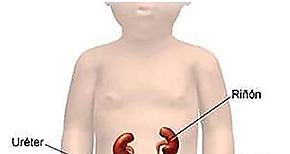 Cmo identificar y prevenir las infecciones genitales en nuestros hijos 