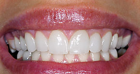 El 32 de los deportistas han visto disminuido su rendimiento a causa de una mala salud bucodental