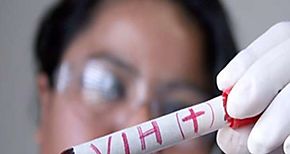 26000 personas viven con VIH en Panam