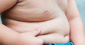 Crece el nmero de obesos en Amrica Latina y el Caribe