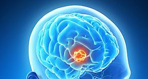 Desarrollan en China dispositivo para deteccin temprana de cncer