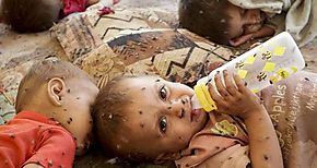 Algoritmo para reducir las muertes infantiles en pases de renta baja