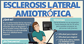 Identifican un frmaco para el tratamiento de ELA