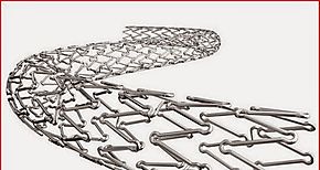 China da luz verde a nuevo estent vascular bioabsorbible