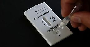 La OPS pide priorizar pruebas rpidas para personas con sntomas de COVID19