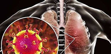 Cinco preguntas sobre el coronavirus