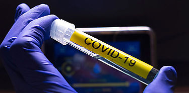 La OMS no descarta que hubiera varios focos primarios de infeccin por COVID19