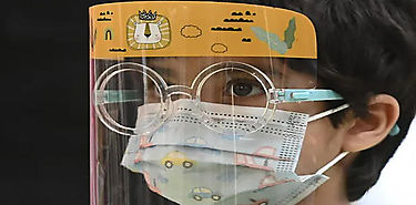 Pandemia de Covid19 incrementa casos de miopa infantil