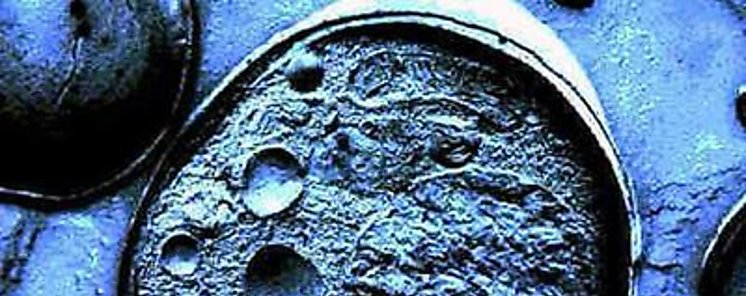 Cientficos hallan una forma para reprogramar clulas madre