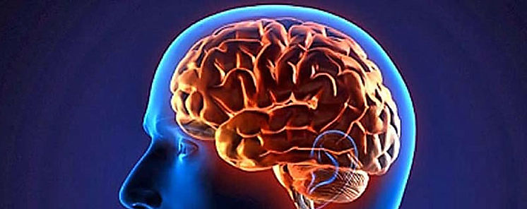 Cientficos hallan una protena que logra eliminar las clulas cancerosas del cerebro