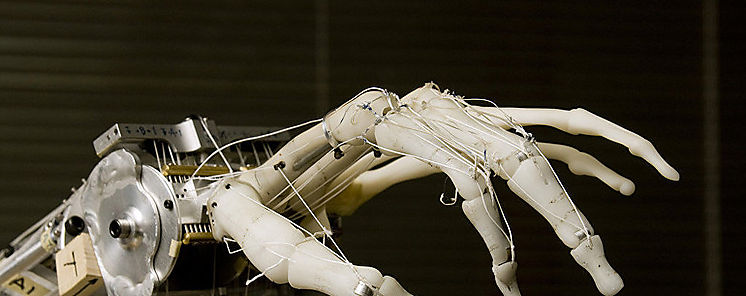 Ciruga de rodilla artificial con robot