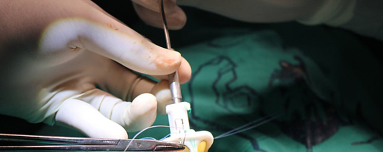 Primer trasplante de pulmn tras COVID19 a partir de donantes vivos