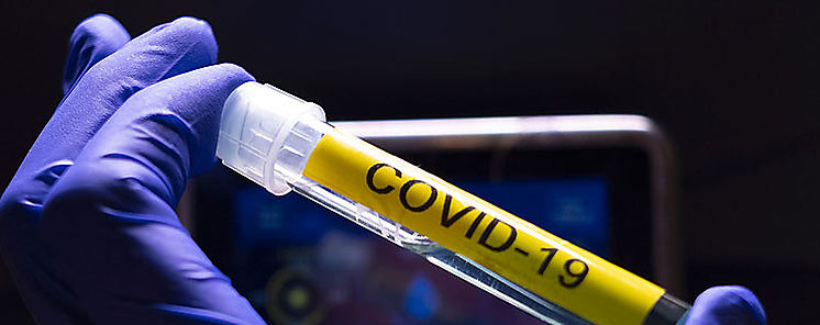 Aumento de 60 de mortalidad por COVID19 en el ltimo mes y medio