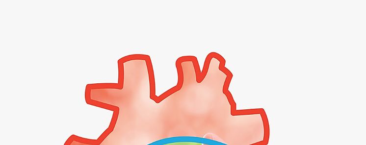 697 millones de personas sufren de enfermedad renal crnica 