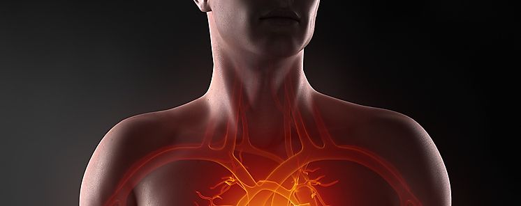 Estudio DELIVER Reduccin de mortalidad y empeoramiento de la falla cardiaca preservada