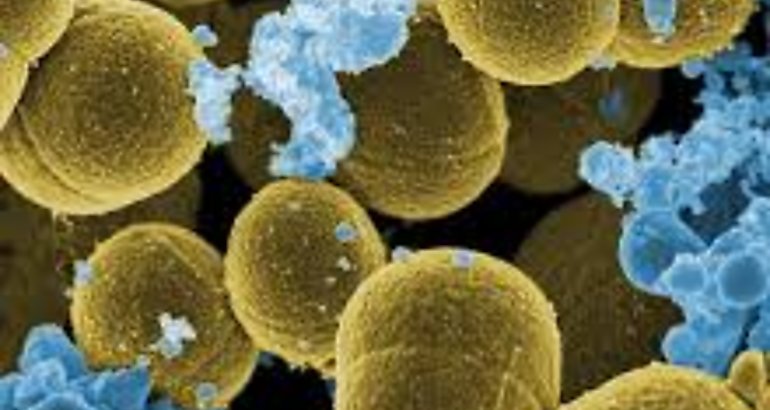 Microbios