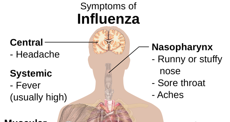 Influenza