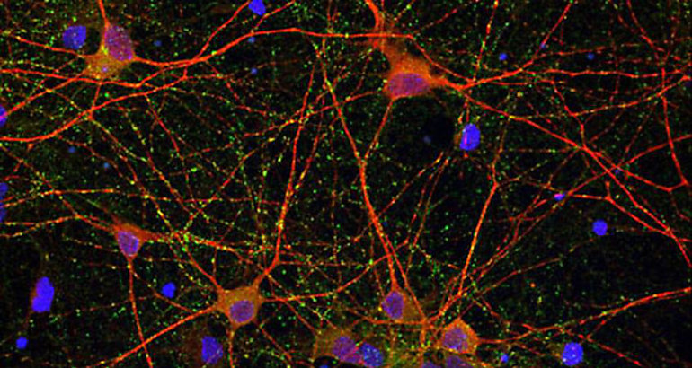 Neuronas
