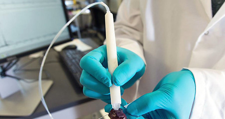 Un dispositivo identifica el tejido canceroso durante la ciruga