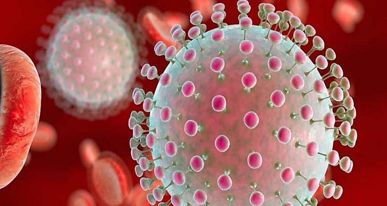 Virus