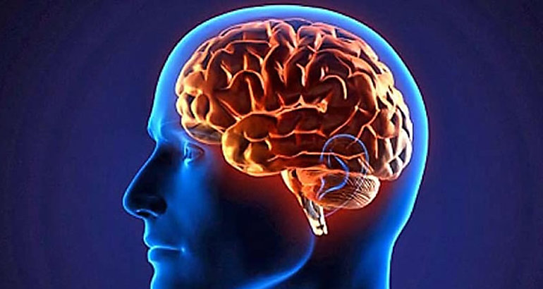 Cerebro 