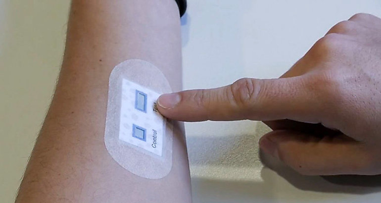 parche para la piel facilita el diagnstico de la fibrosis qustica