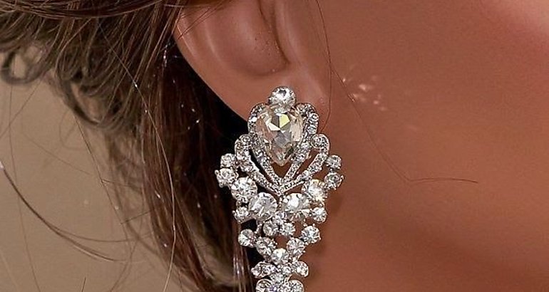 Aretes