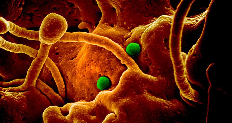 coronavirus
